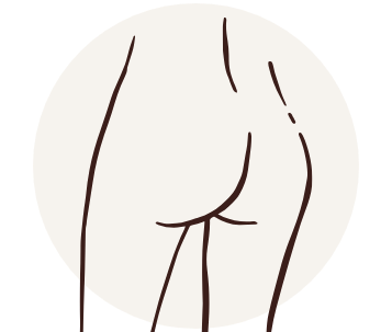 Buttock Lift with Fat Transfer – 2